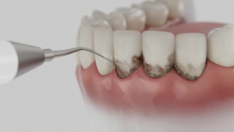 Reliable Tooth Extraction contractor in Lorain, OH by Smile Center Dentistry